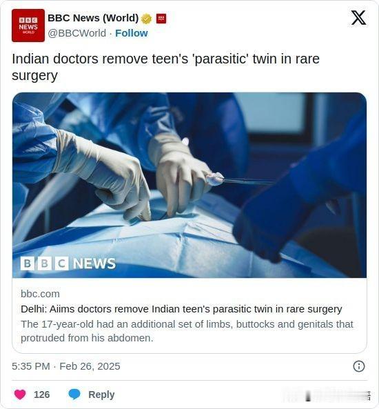 双语简讯：Indian doctors remove teen's 'paras