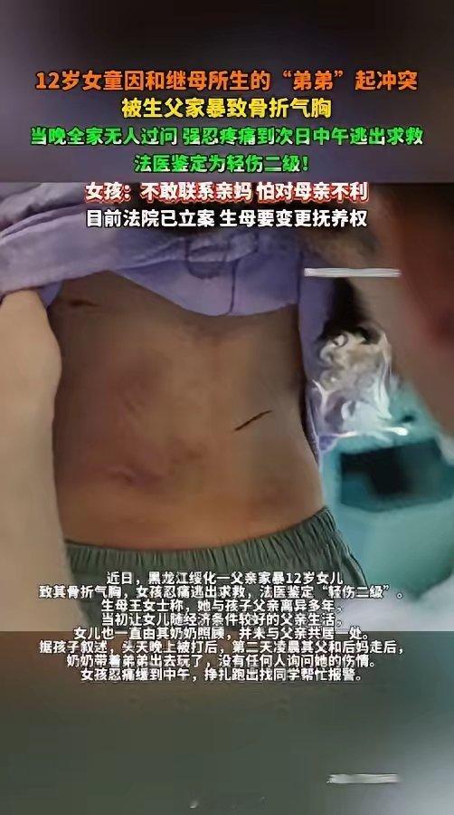 12岁女孩被生父家暴致胸骨骨折，懂事到让人心碎💔黑龙江绥化12岁女孩的遭遇看得