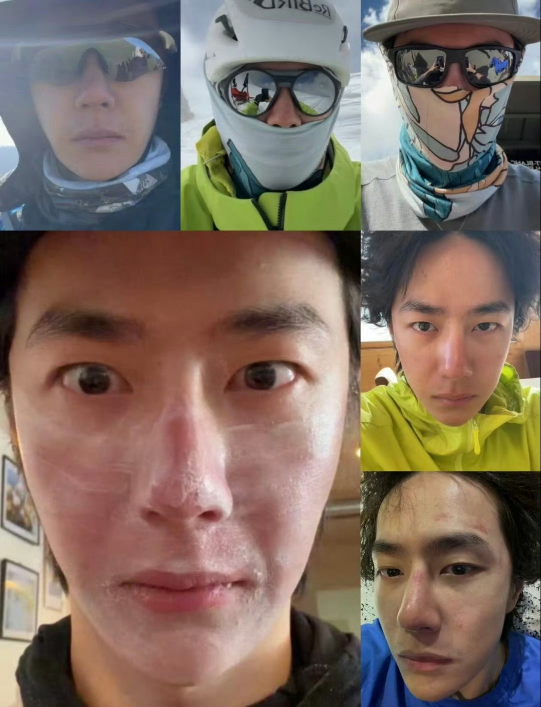 王一博[超话]王一博ins素颜自拍 wyb 王一博的脸晒伤了 直面真实，素颜自在