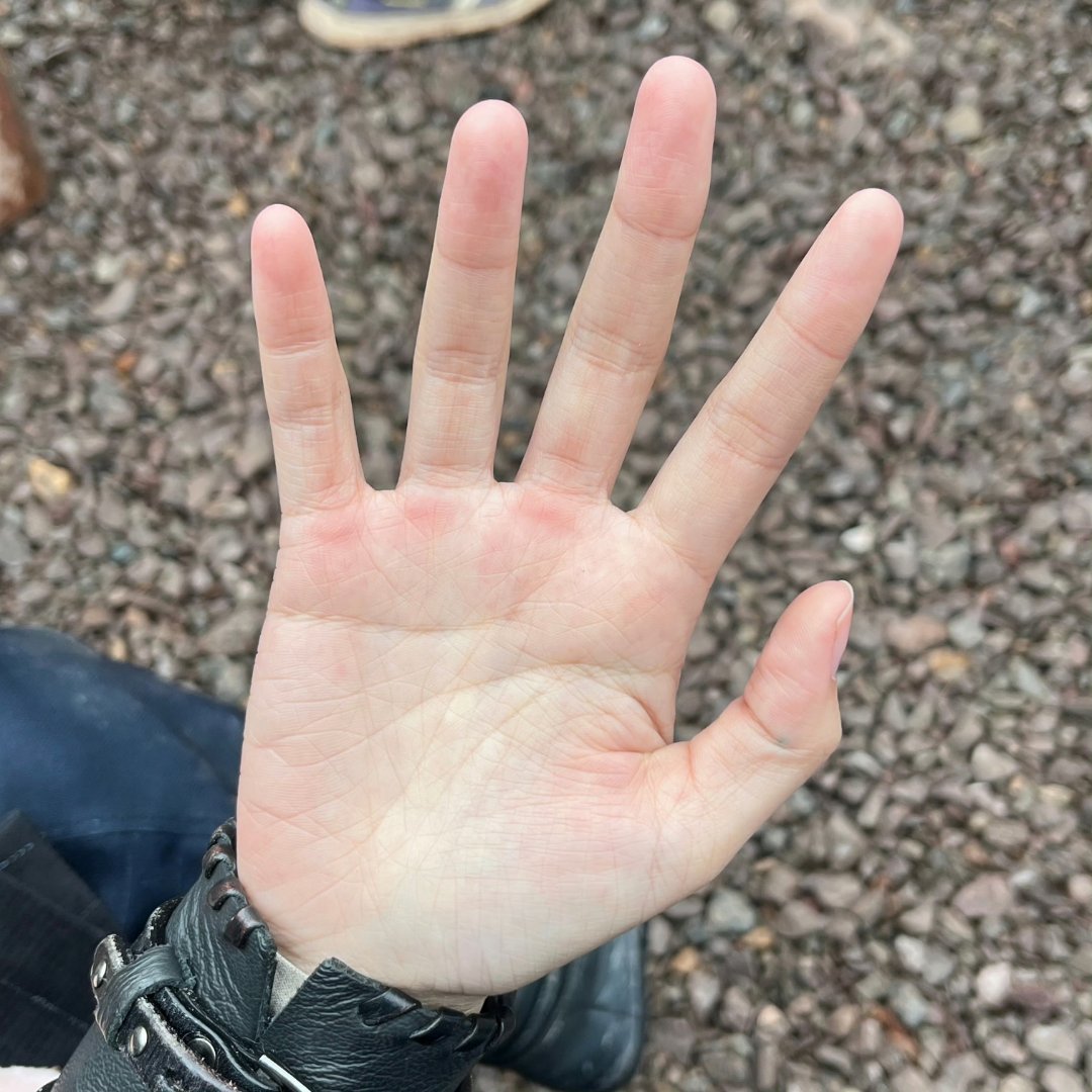 看着就疼周也