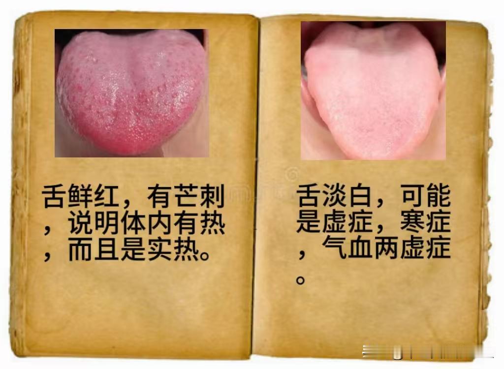 今日舌诊挑战，专门抽出时间看舌象，看到的都会回复，没回复的可以再多发一遍，为大家