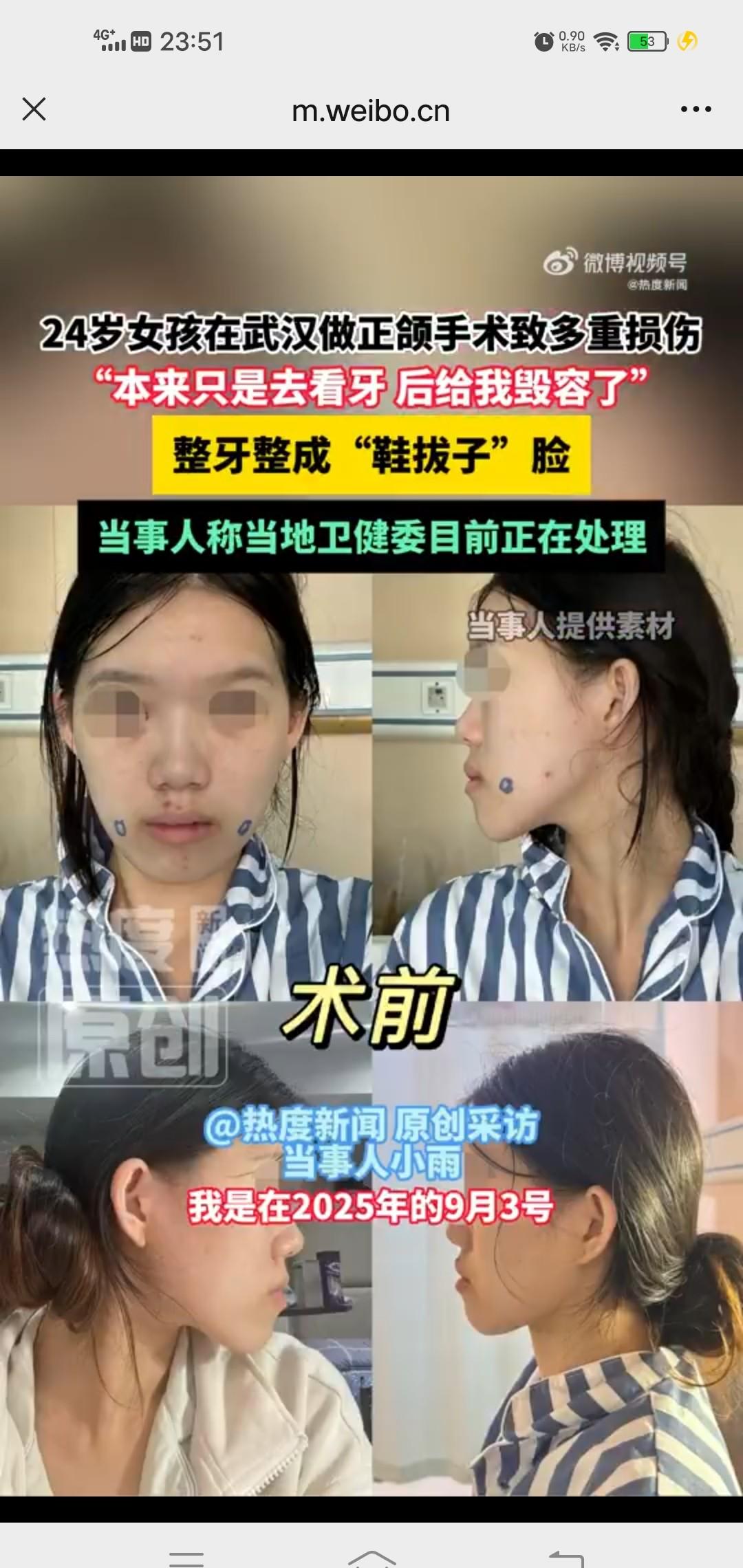 正颌手术火了，

网上疯传“拉13mm翻车”，

武汉大学口腔医院却查无此人。