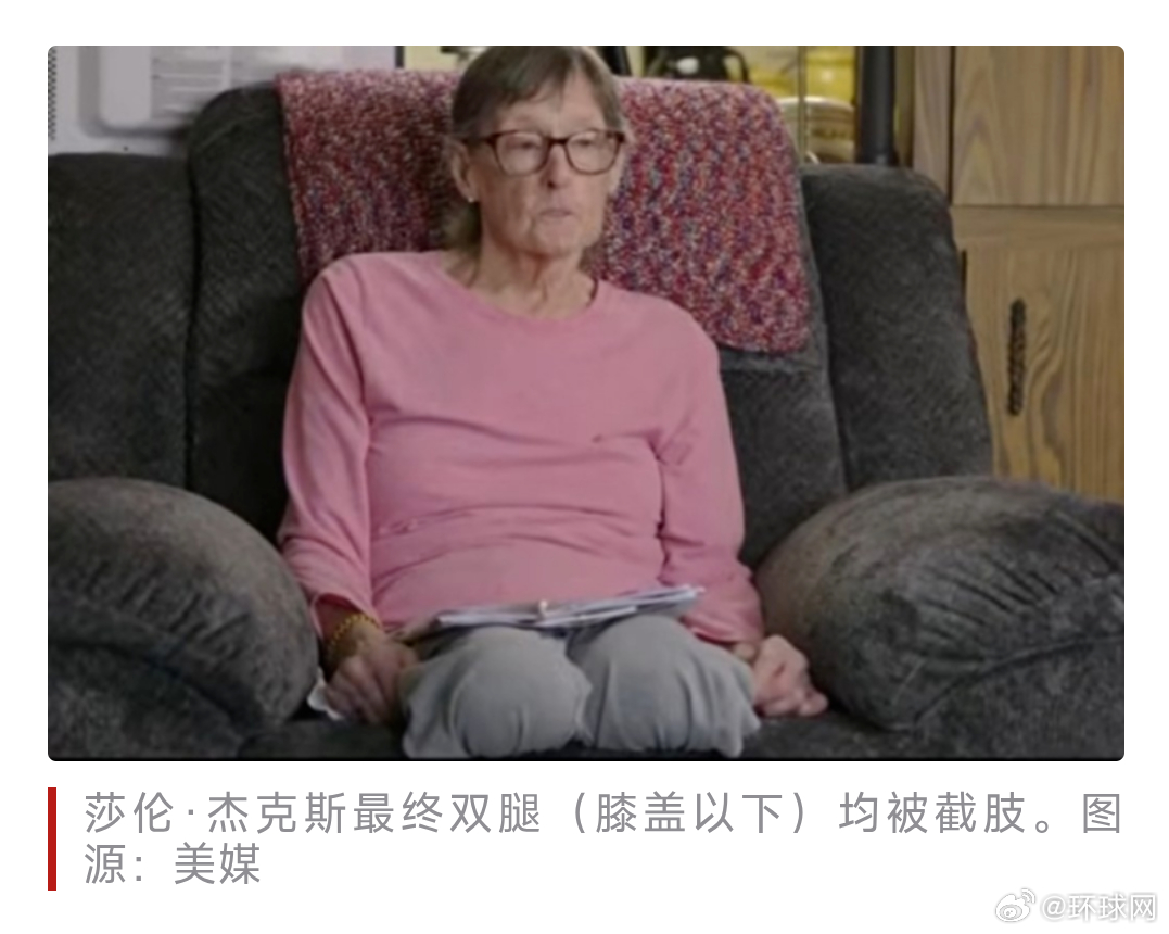 #美74岁老人被截错腿最终双腿截肢#【美媒：美国74岁退伍女兵起诉医院，控告医生