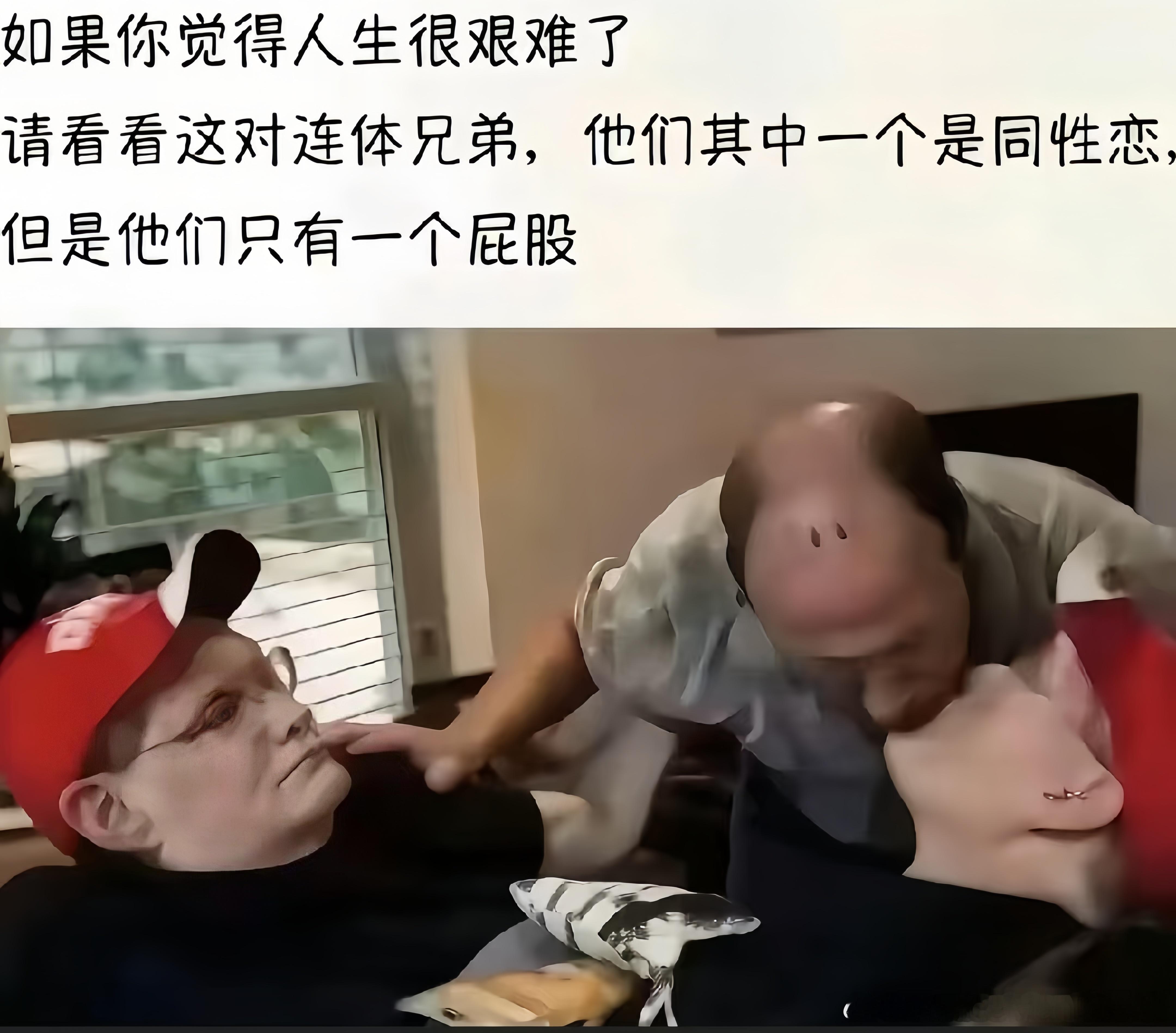 如果你觉得人生已经很艰难了，看看这对连体兄弟吧…… 