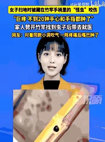 万万没想到！四川雅安一位女子在家扫地时，竟被扫把柄里窜出的一只“怪虫”狠狠咬了一