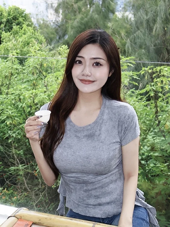 骨性嘴凸厦门正畸，内收后感觉口周都年轻了