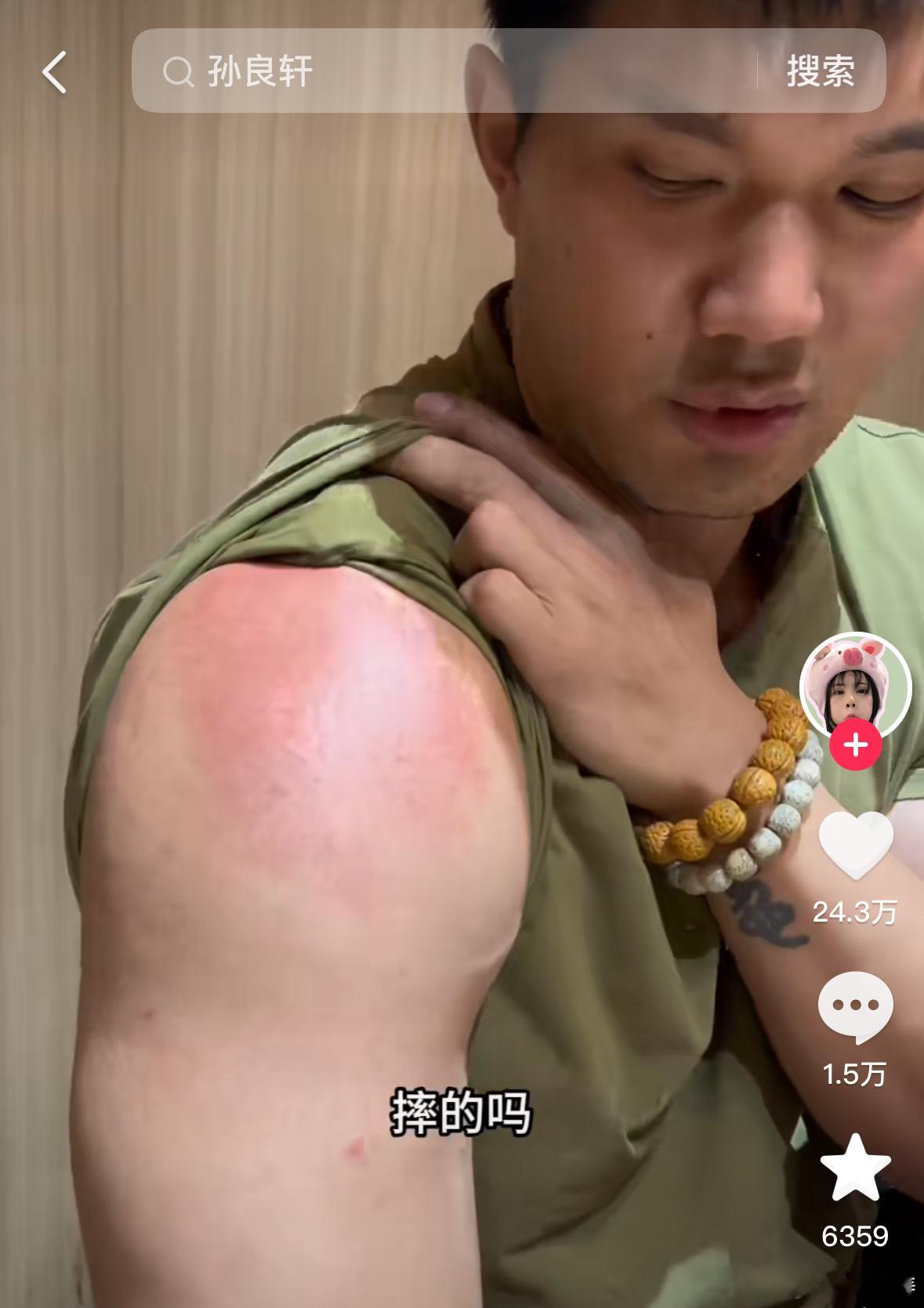 #知名水上闯关类综艺录制现场突发意外#看到孙良轩落水后也说自己受伤了，应该是有点
