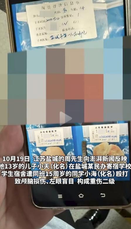 刚开完防欺凌大会，15 岁男生在宿舍把 13 岁同学打到左眼失明、右侧偏瘫！判了