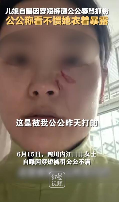 “清官难断家务事！”四川，一儿媳因天气热穿了条白色短裤，竟被50多岁的公公指着鼻