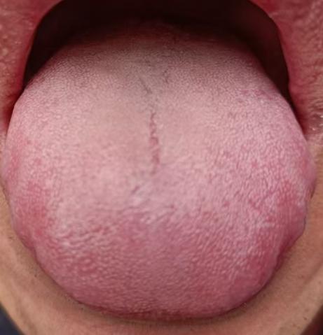 气血不足，精力难持久，经典时方助力调理






很多男士朋友海绵体质量低下起