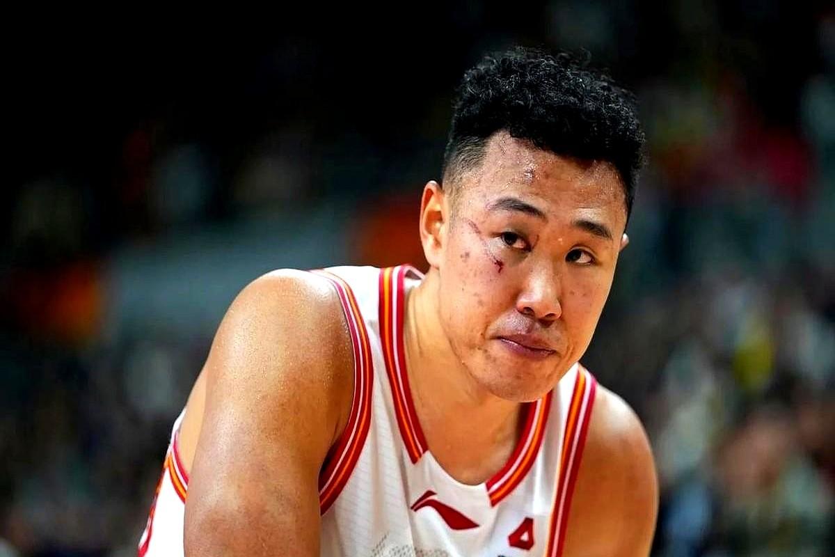 一个月缝3次针，鼻骨骨折！深圳队的贺希宁，这是在打球还是在搏命？

就在1月5号