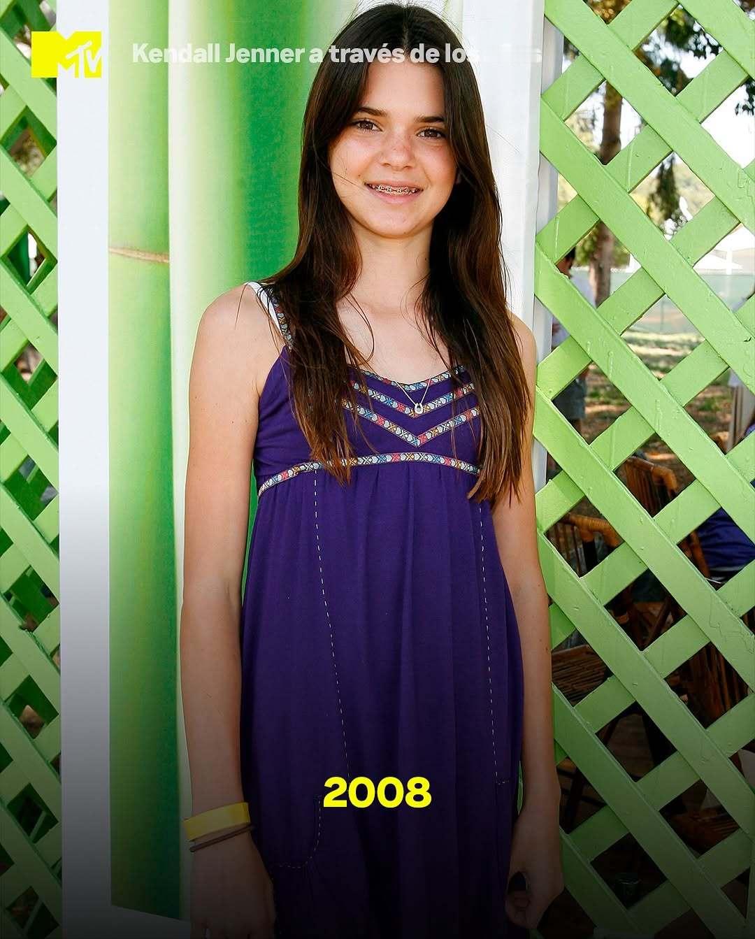 肯豆容颜变化图，看出来哪里动刀子了嘛？ ​​​