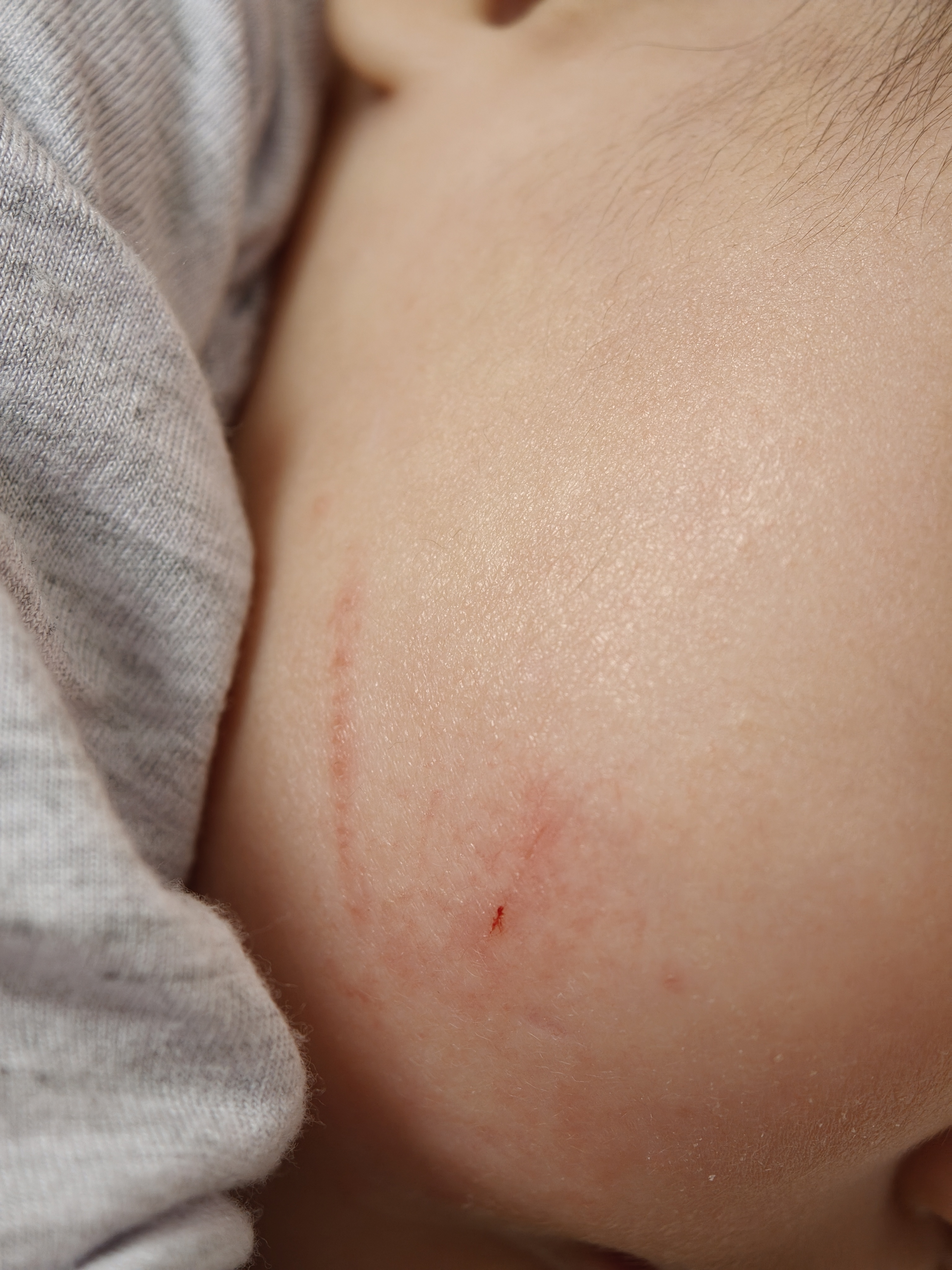 我擦，一会儿没看住小牙就给自己脸一下，太狠了，都抓出血了。小牙真给她爹上眼药啊，