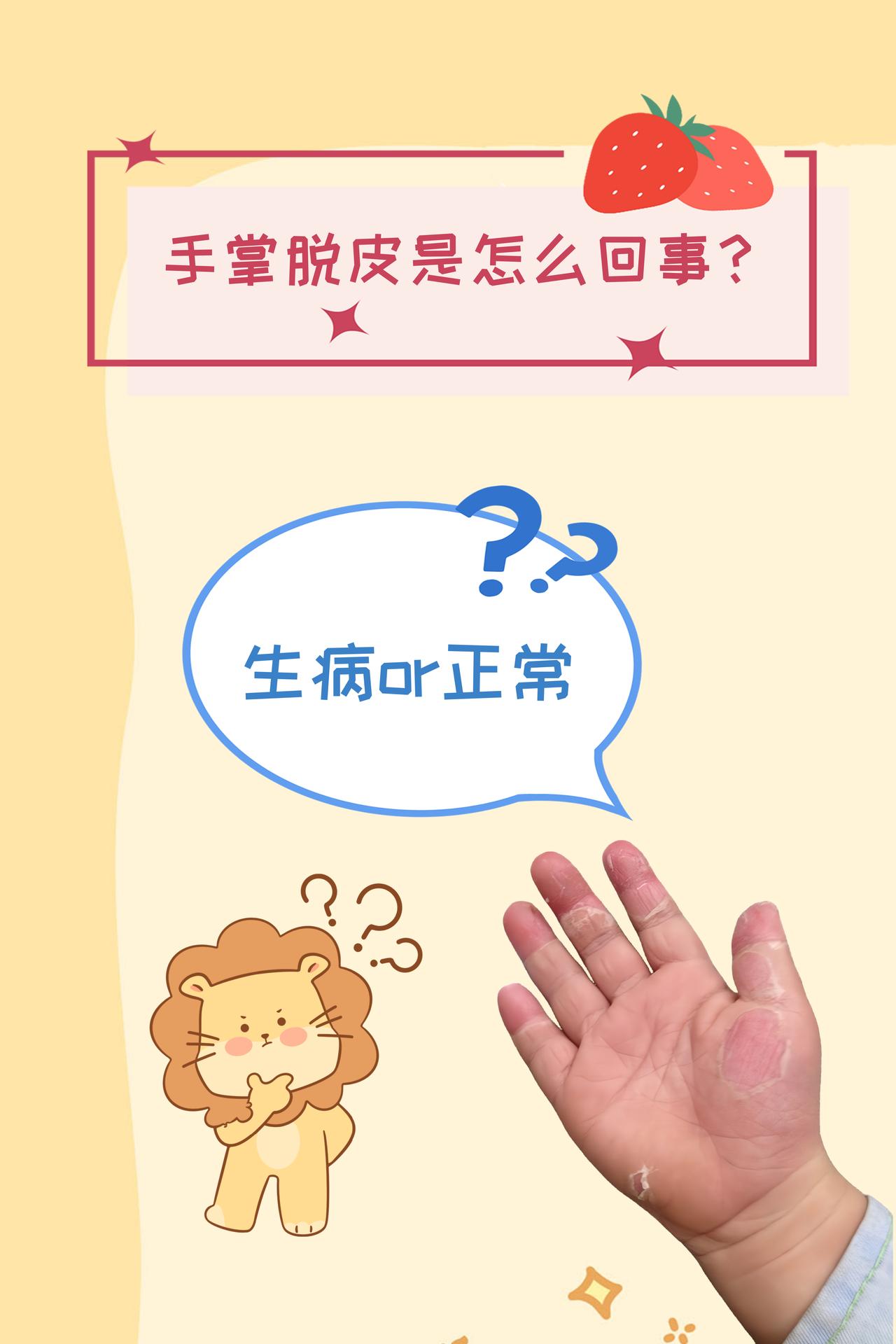 【手掌脱皮是怎么回事？】
 
最近一段时间，全国各地都被呼吸道疾病闹得鸡犬不宁，