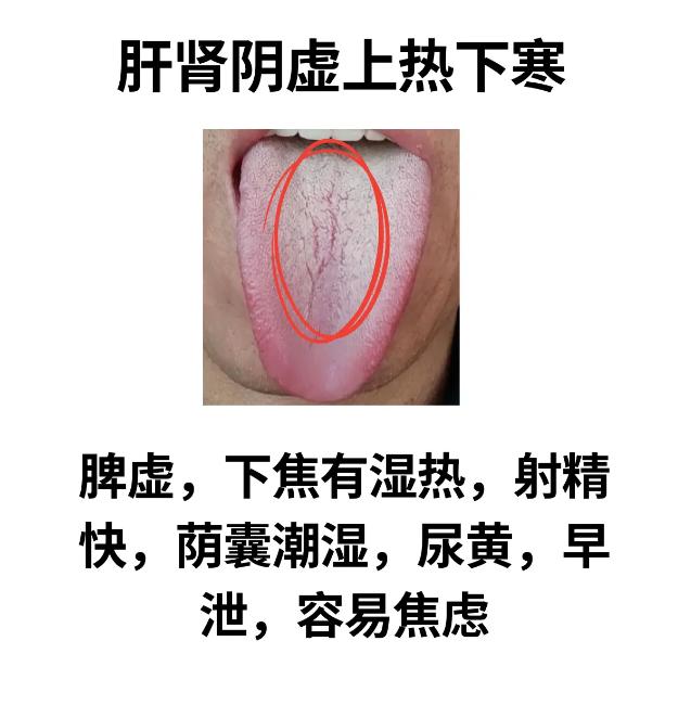 中医舌象分析，辨证论治！