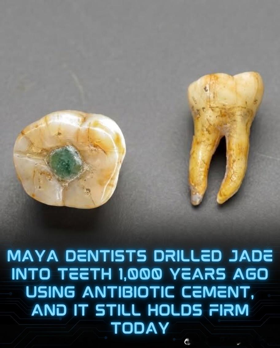 古代玛雅牙医利用先进的粘合剂保护牙齿免受蛀牙侵害。早在现代牙科出现之前，公元25