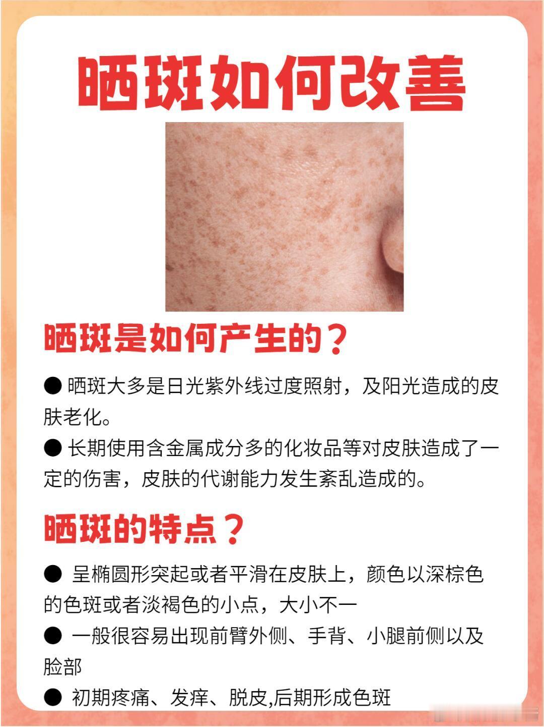 护肤分享功效护肤 皮肤为什么会出现晒斑？怎么淡化晒斑？什么是晒斑？[微风][微风