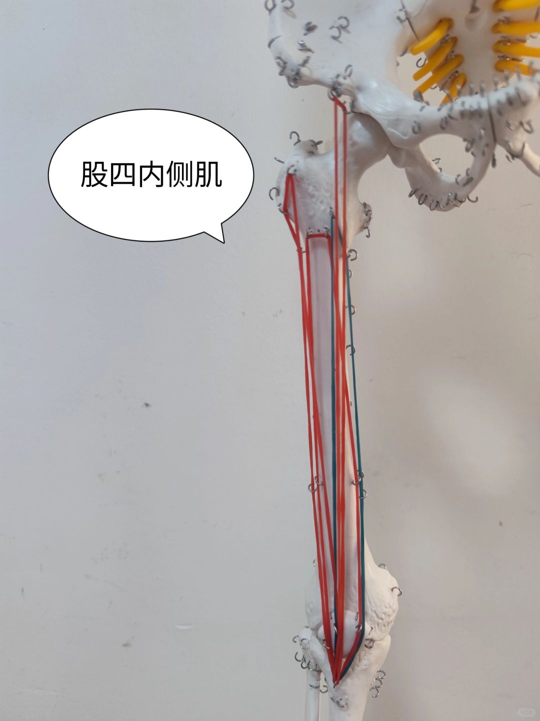 股四头肌——股四内侧肌