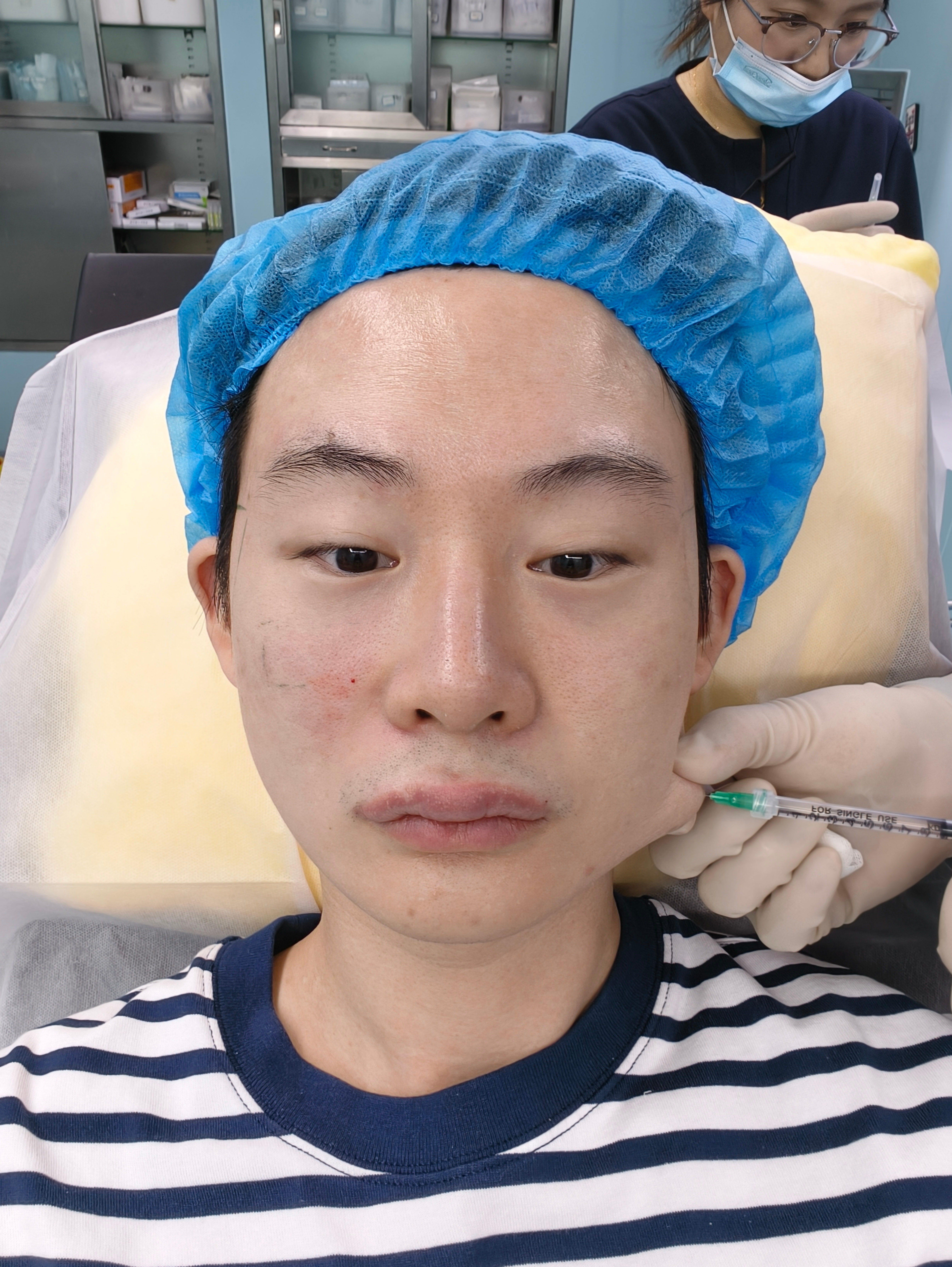 老公说我嘴巴亲起来像硅胶，让我把嘴巴的便宜啵啵给融了不过新针头扎嘴巴竟然不疼 