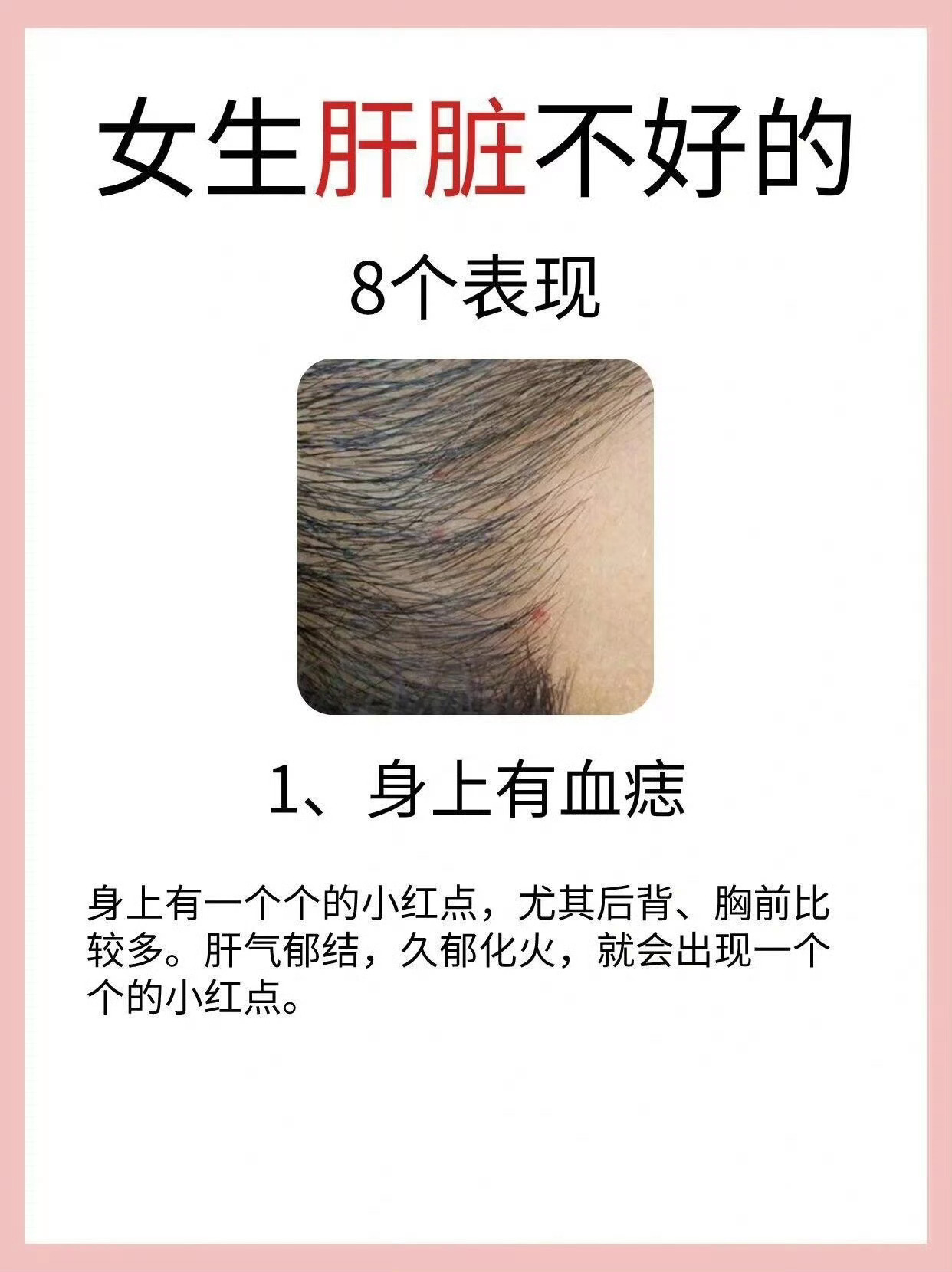 肝脏不好的表现和养肝方法 