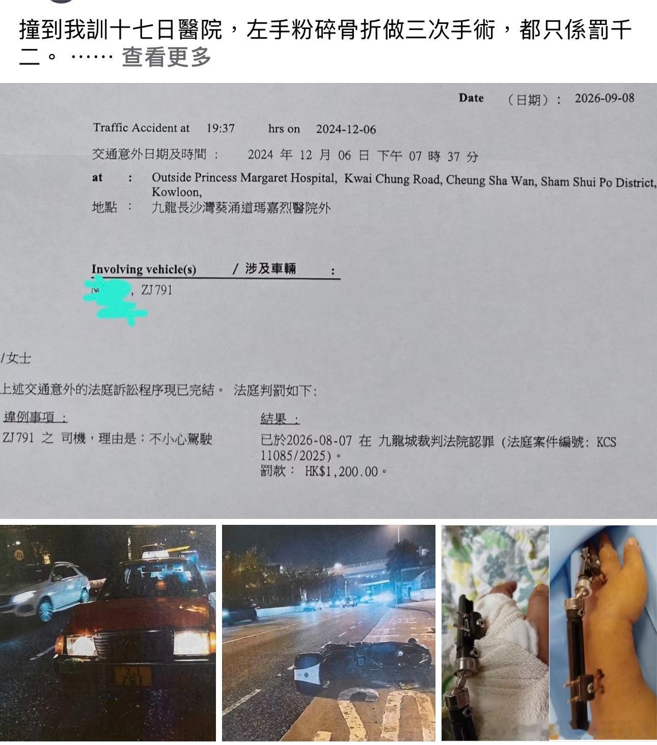 香港被撞到骨折，手术三次，肇事司机仅罚款1200元…，代价太低 ​​​