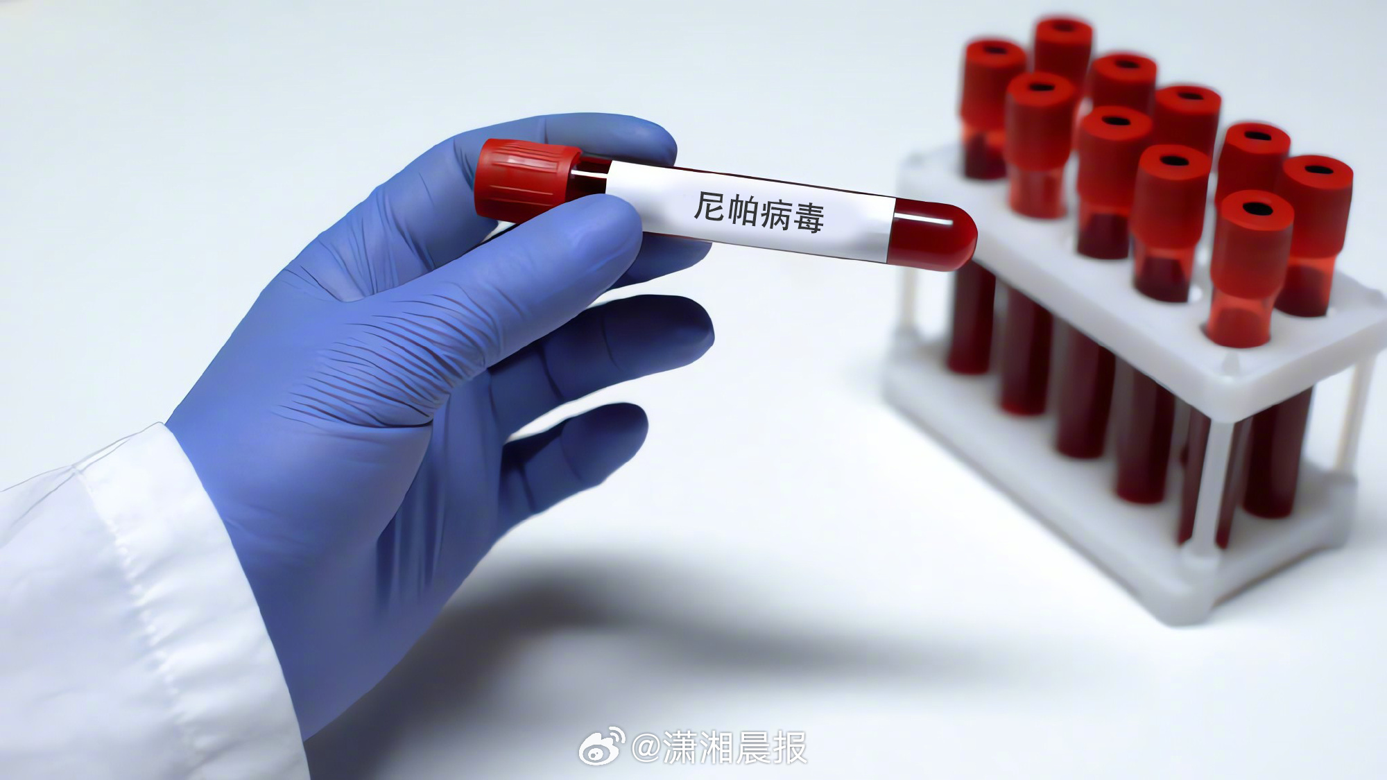 【#果蝠是尼帕病毒主要传染源#】据印度媒体报道，印度东部的西孟加拉邦近期出现尼帕