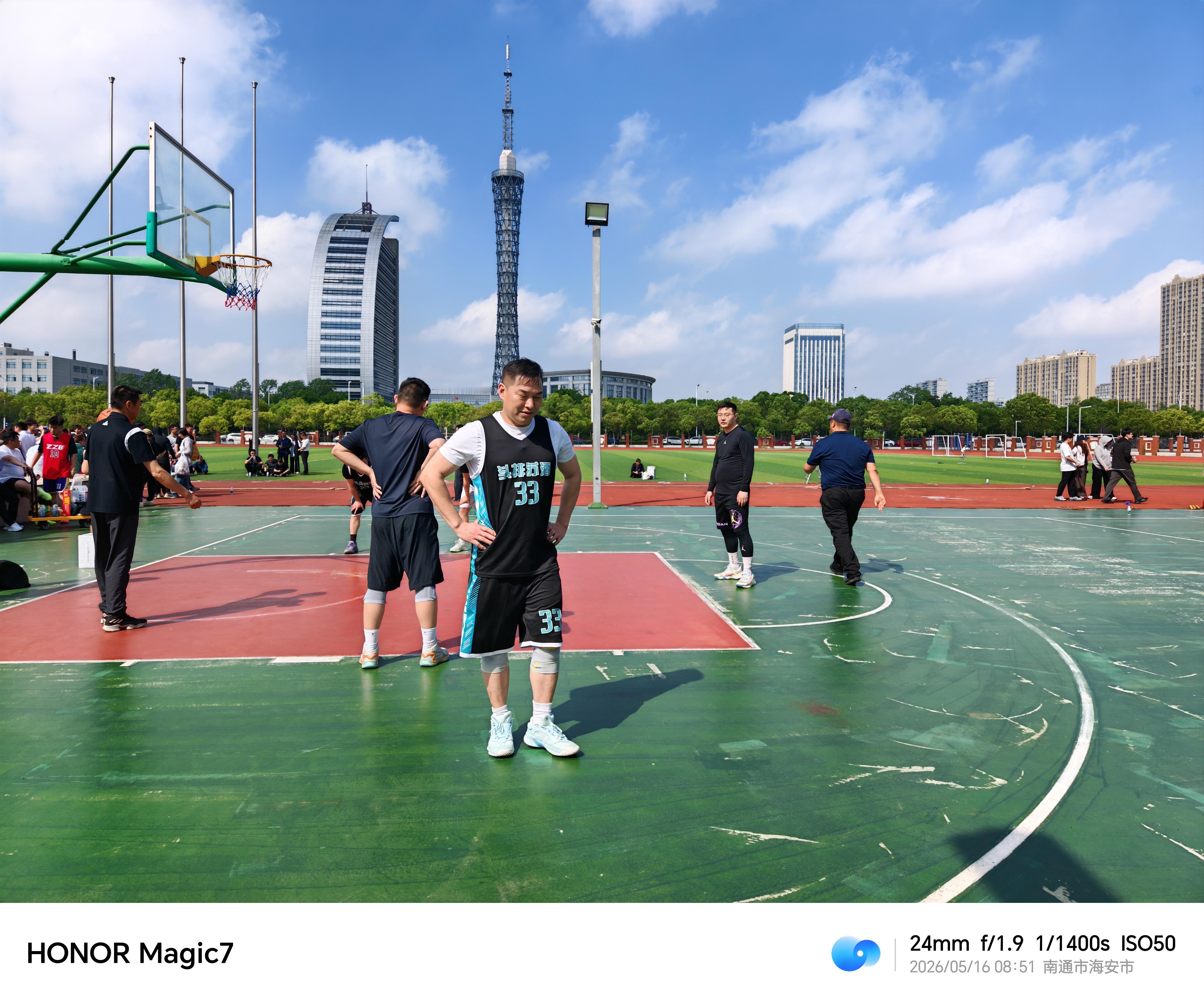 小周参加三人篮球赛，虽然最终得了二等奖，但又是受伤的一天！ 
