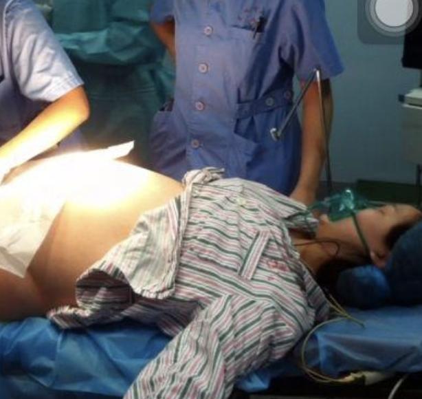 30岁的冯女士怀了龙凤胎，顺产前问医生“能不能想办法让哥哥先出生”，因为想让孩子