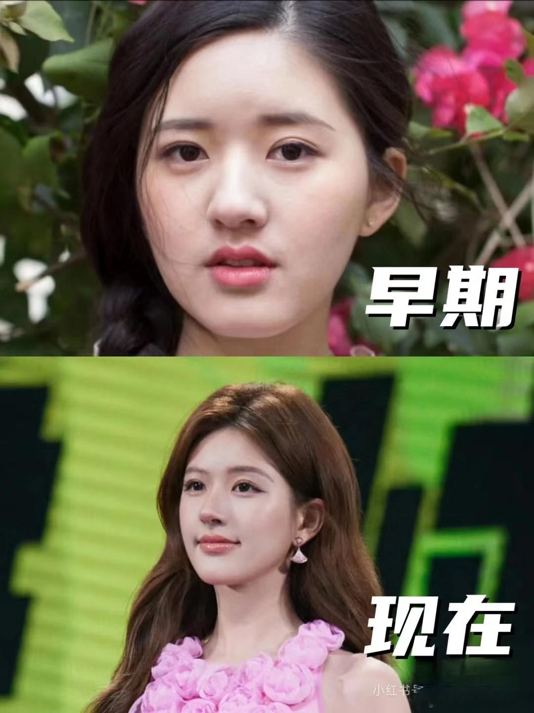 瘦了、荨麻疹病了，人家李兰迪瘦下来也没变脸啊[疑问] ​​​