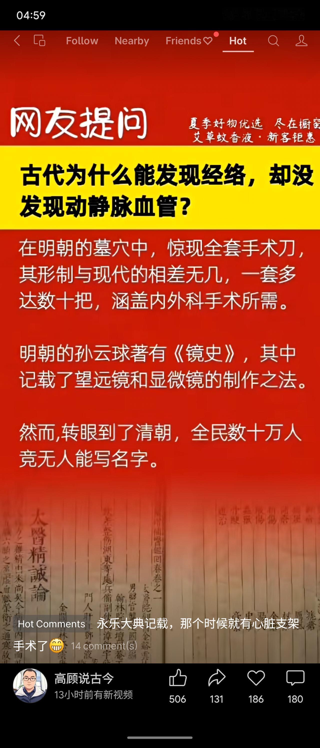网友问古代为何发现经络却没发现血管。内容提及明朝墓穴出土全套手术刀、孙云球《镜史