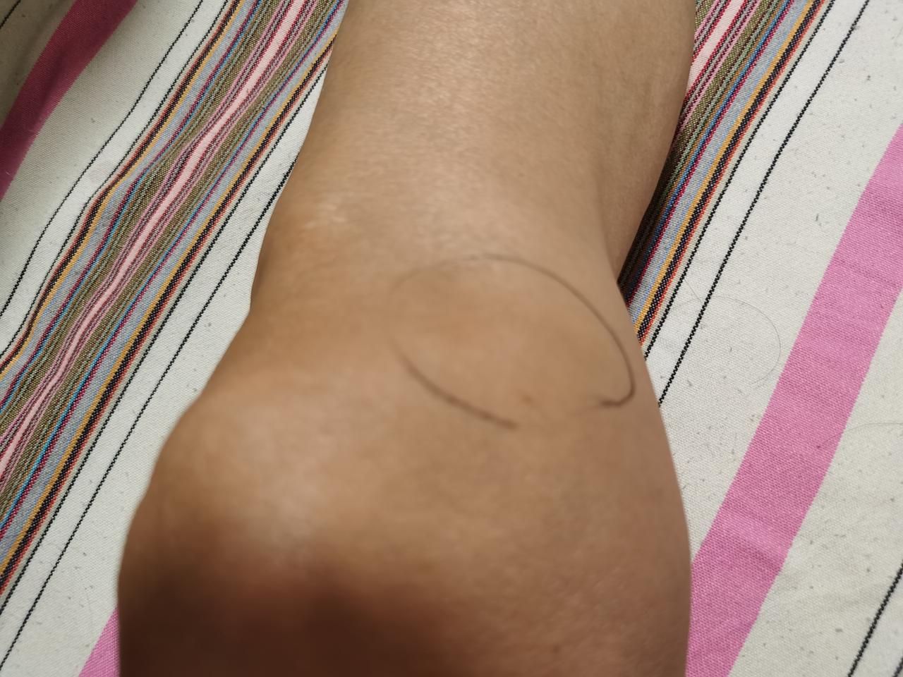 岁数大了，可千万别逞能，特别是这腿！惨痛的教训！

我慢跑已经三年了，现在一点也