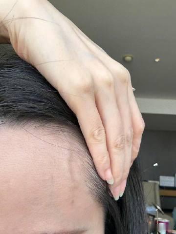 张靓颖一伸懒腰手掌就流血张靓颖伸懒腰手掌流血这一事件，无论是从健康角度、艺人工作