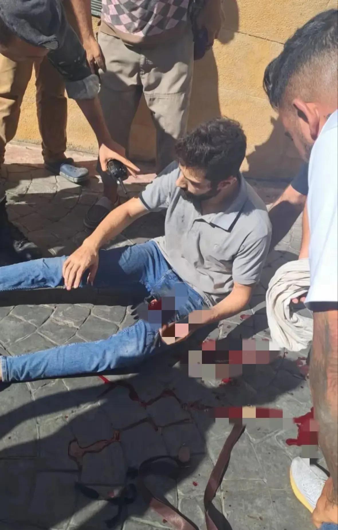 这次黎巴嫩iconBP机集体爆炸造成的伤害不容小觑，你想想平时BP机放在哪里？