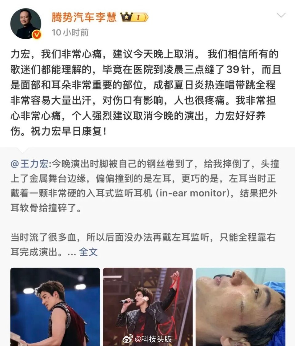比亚迪代言人王力宏摔倒受伤，李慧发文关心，建议取消演出引争议。网友出招：应该顺带