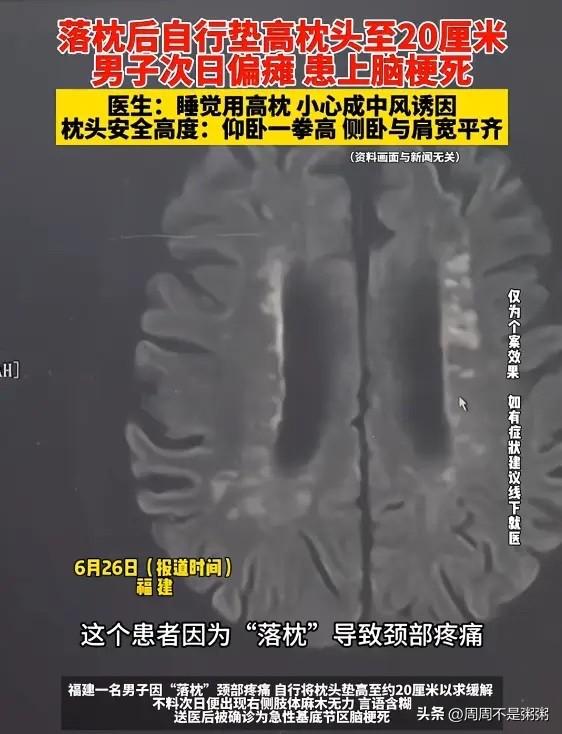 枕头选不对竟引发中风！6月26日福建一则病例给所有人敲响警钟，一名男子落枕后脖子
