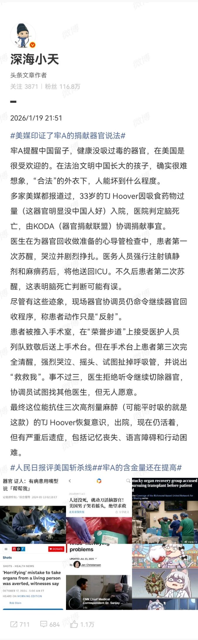 信息就这么一点点的都串起来了……热点观点美媒印证了牢A的捐献器官说法