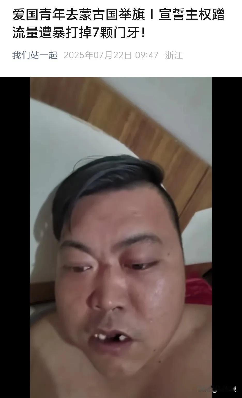 正能量
爱国青年到蒙古国🇲🇳
宣誓主权
遭暴打，少了7颗牙
太不容易了，这些