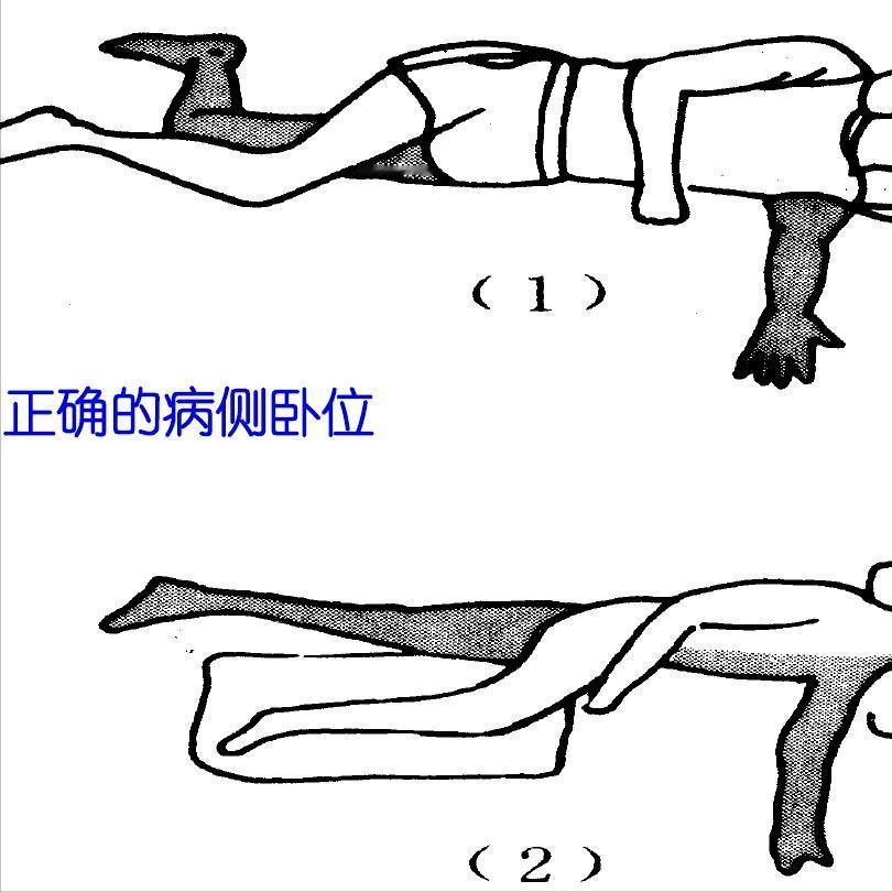 偏瘫卧位不对，后续锻炼都白费！
1. 半卧位
半卧位是大家最容易犯的错误，总认为