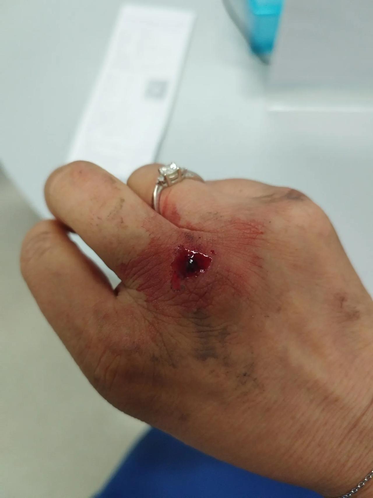 我现在明白为什么有的老人摔倒被扶起后，会讹扶他的人，不是说所有讹人的老人都是无赖