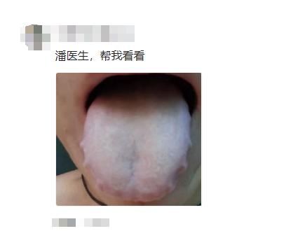 齿痕舌背后的健康秘密！湿气重？补错更伤身！
🔍 痰湿体质的真相
痰湿体质的形成