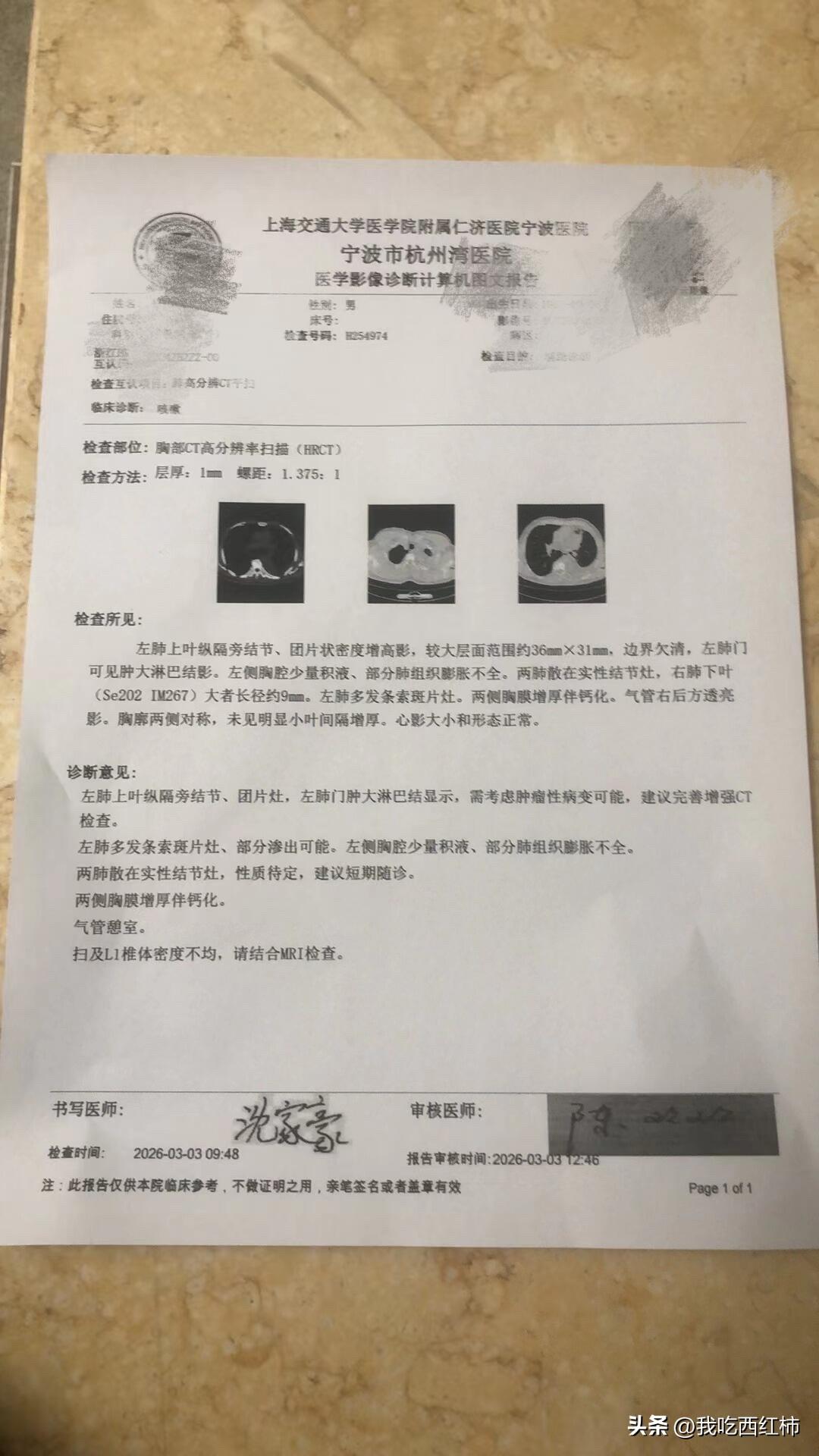 年前稍微有几声咳嗽，还以为是普通感冒，医疗站挂了几瓶盐水，持续了半个月一直还是偶