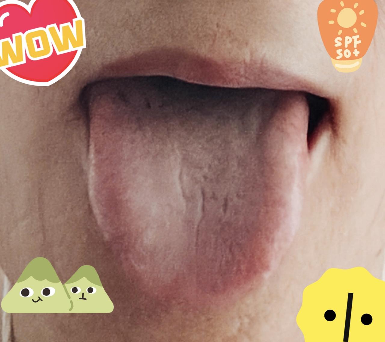 我每天早上醒来的第一件事是 
张开嘴巴看看舌面
因为一直下雨，
有和我一样的吗？