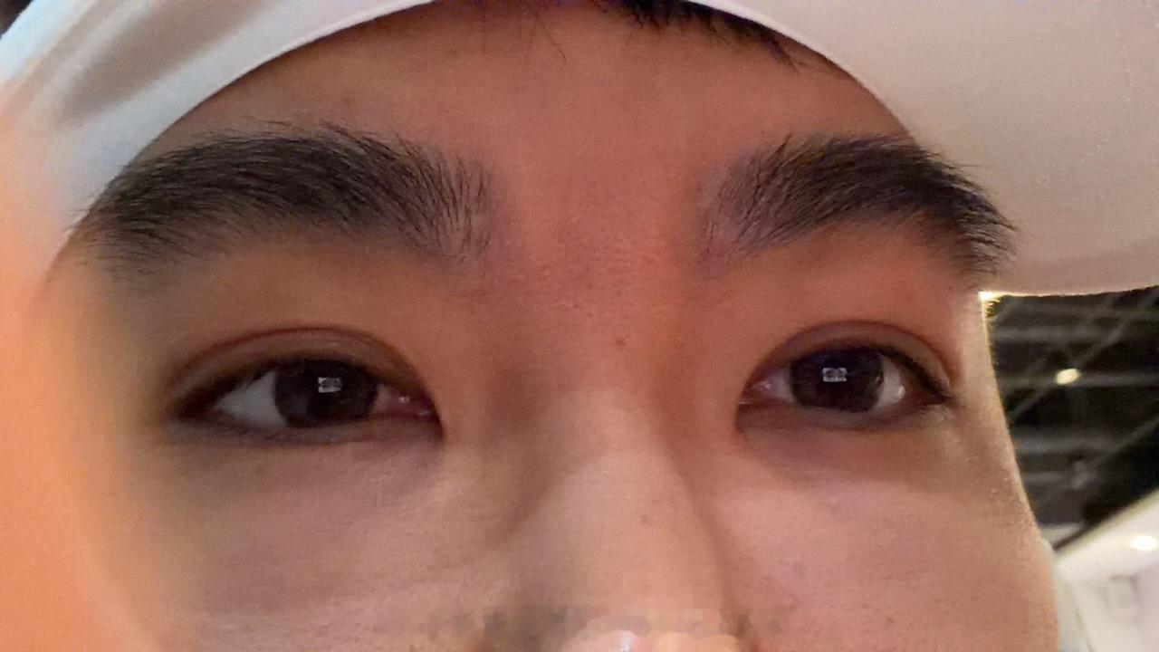 每天睡太久，导致眼睛都很肿，然后双眼皮变很大。