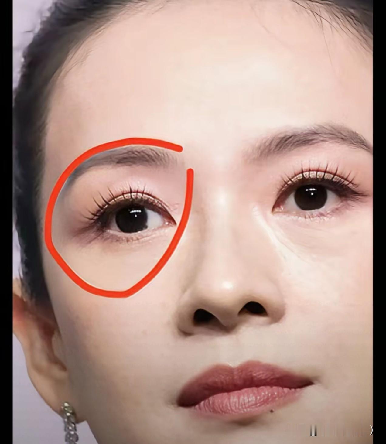 真的没留意看呢，原来章子怡大美人左眼睛内有粒痣，应该是好痣事业辉煌有钱人痣了。