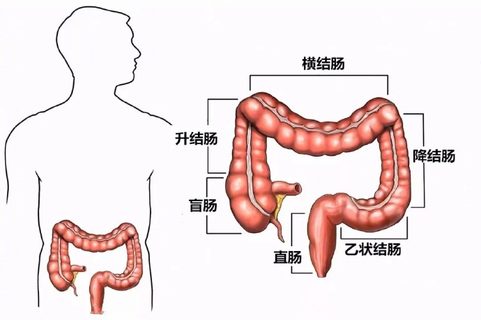 【#肠癌有哪些信号#】#从息肉发展到肠癌仅4步# 肠癌的发生发展，大多会经历“小