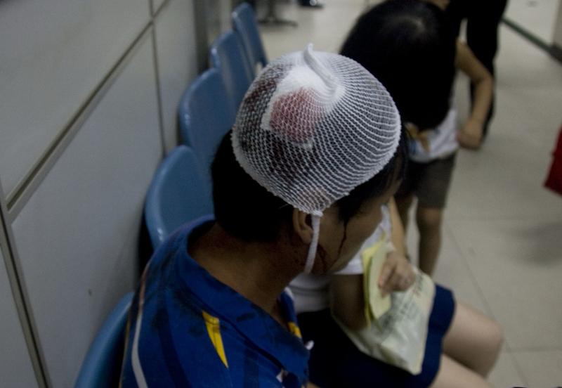 “掐人中”应对晕厥，真没那么科学。从中医看，人中穴有醒神开窍等功效，能用于浅度昏