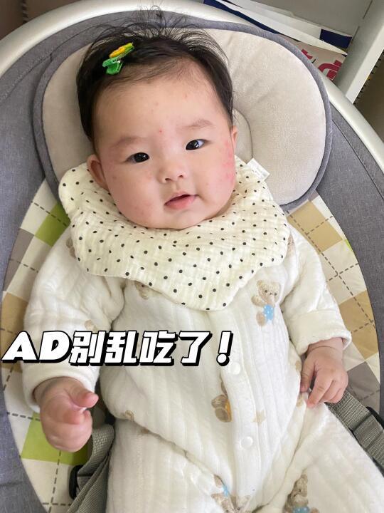 震惊了😳才知道吃AD也会敏敏