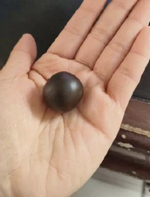 自己乱吃“多子丸”，真怀上四胞胎，结果还是留不住。
江苏这位备孕的姐妹，图省事自