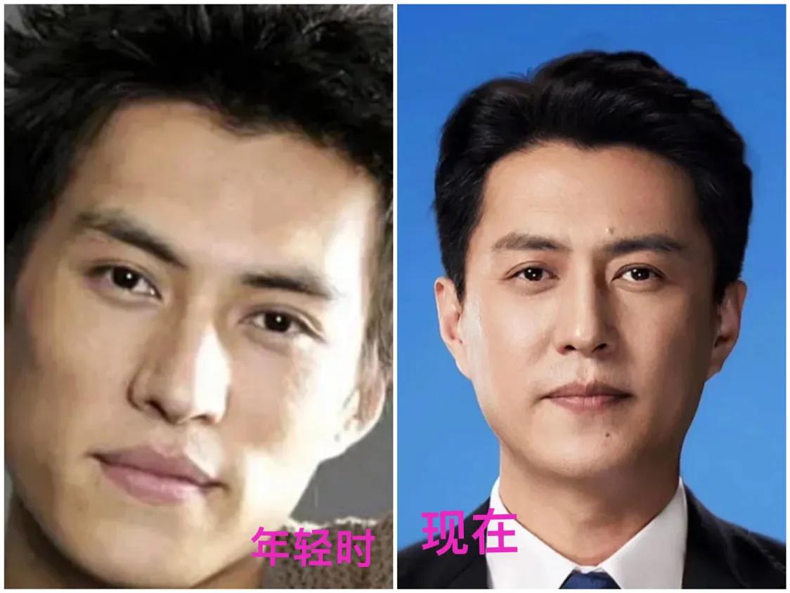 靳东颜值真的是逆袭了！他年轻时的长相好一般呀，和街上普通长相的路人毫无差别，脸长
