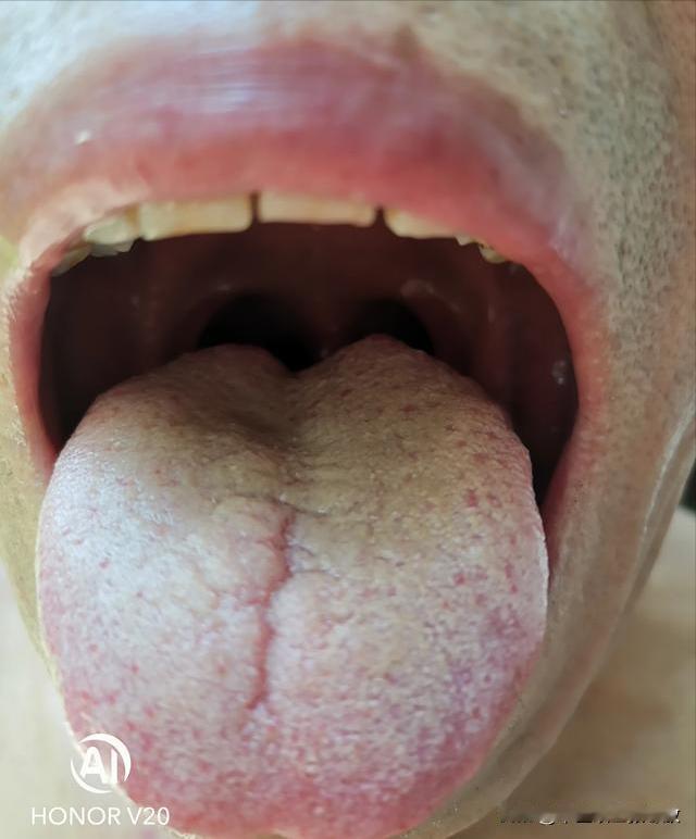 大哥，你都40多了，又不是小伙子，节制点吧[黑线][黑线][黑线]
 主诉：腰膝